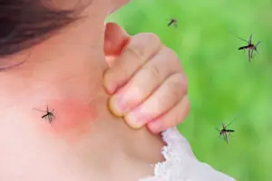 Mosquitoes Biting Child