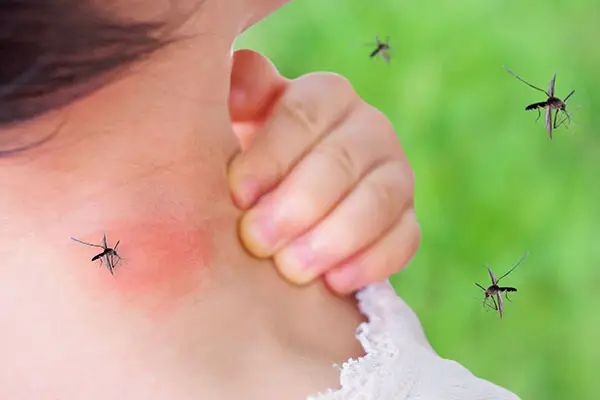 Mosquitoes Biting Child