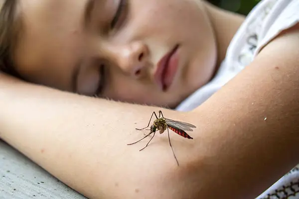 Mosquito bite